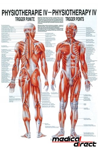 Anatomische poster: Triggerpunten fysiotherapie